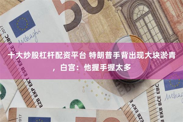十大炒股杠杆配资平台 特朗普手背出现大块淤青，白宫：他握手握太多